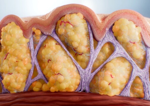 The science of cellulite.