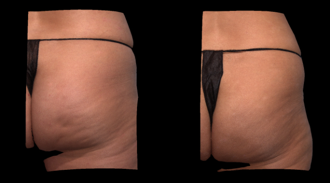 3D color view. Right side.