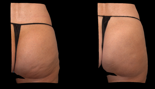 3D color view. Right side.