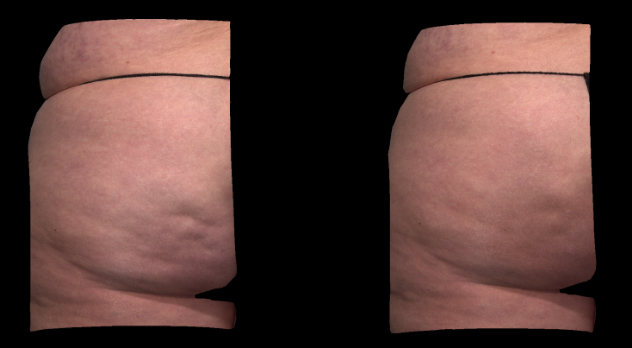 3D color view. Left side.