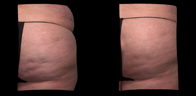 3D color view. Right side.