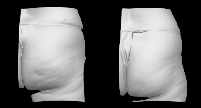 3D grayscale view. Right side.