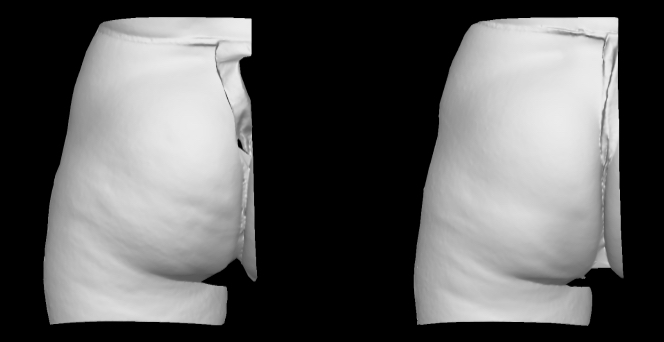 3D grayscale view. Left side.