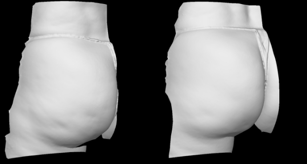 3D grayscale view. Left side.