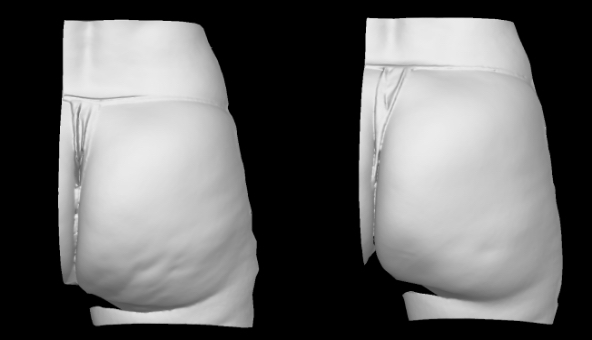 3D grayscale view. Right side.