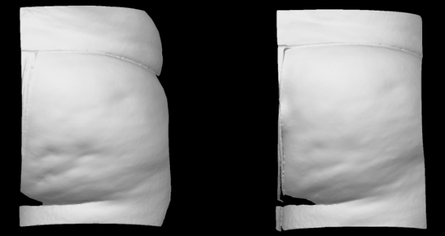 3D grayscale view. Right side.