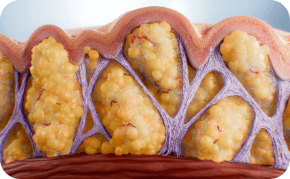 The science of cellulite.