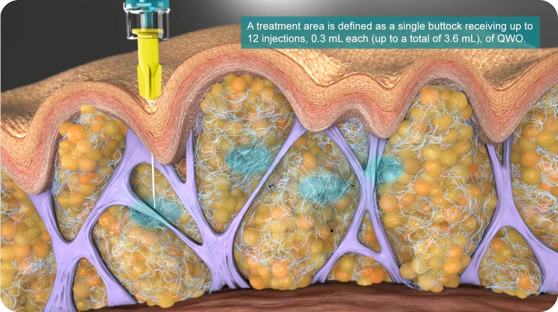 Mechanism of Action video.